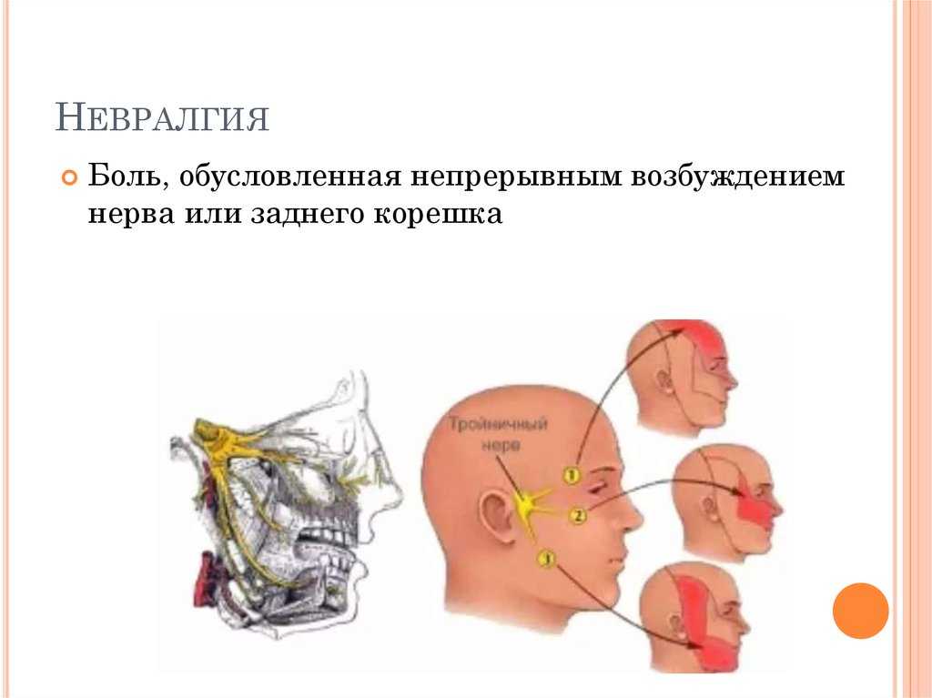 Галлюцинации. почему они возникают и как проявляются?
