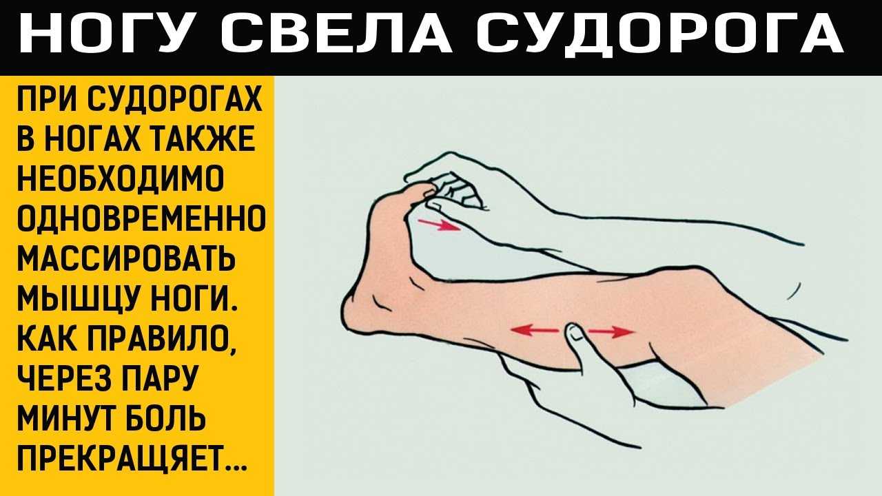Судороги руки причина и лечение у женщин. При судорогах в ногах.